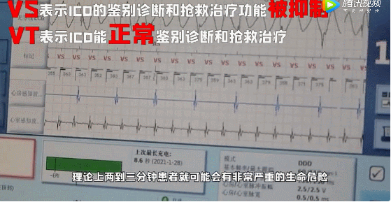 苹果iPhone12实测可逼停心脏除颤器