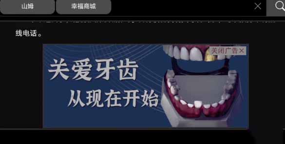 《黑暗笔录》金牙获取方法