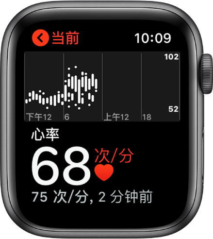 如何使用 Apple Watch 监控心律异常？